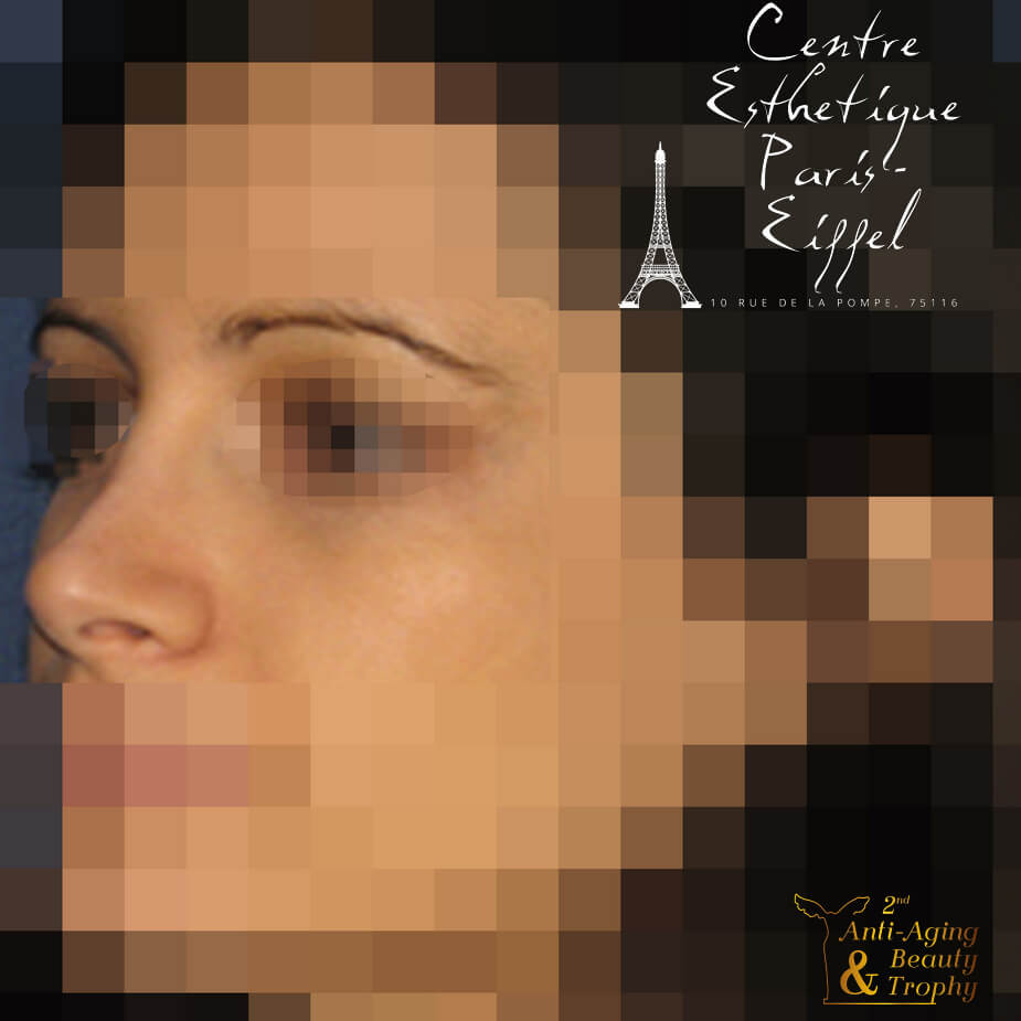 meilleur cas clinique centre esthetique paris eiffel