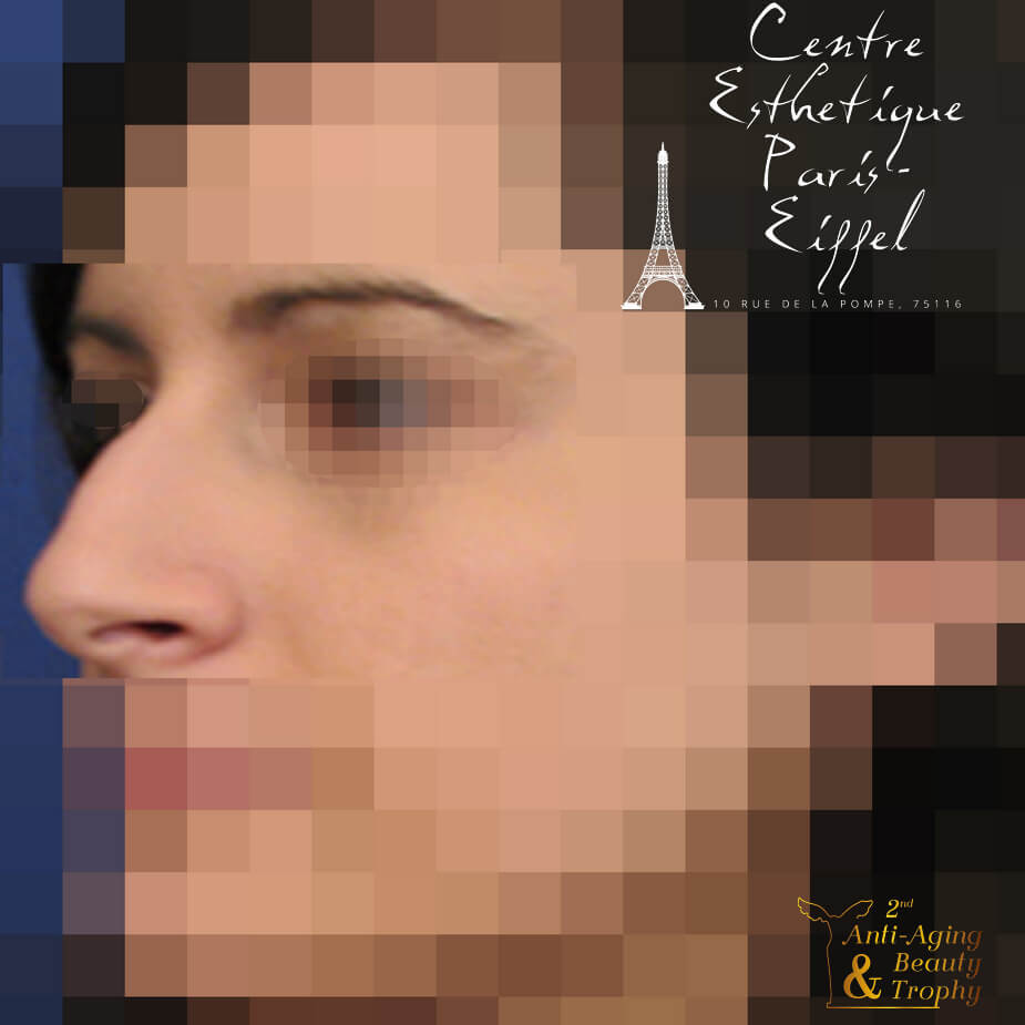 meilleur cas clinique centre esthetique paris eiffel